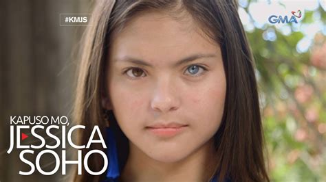 heterochromia pinay|Kapuso Mo, Jessica Soho: Dalagang magkaiba ang kulay ng .